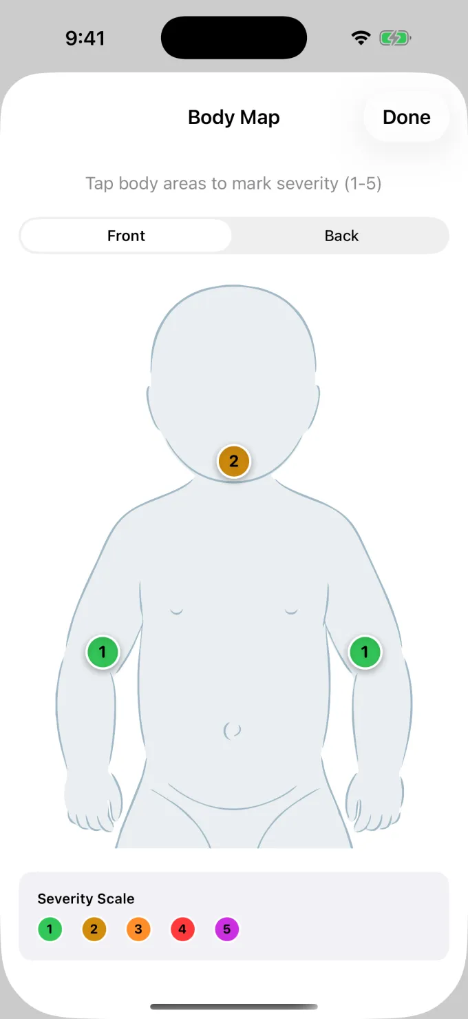 Interactive body map with severity markers on different body regions
