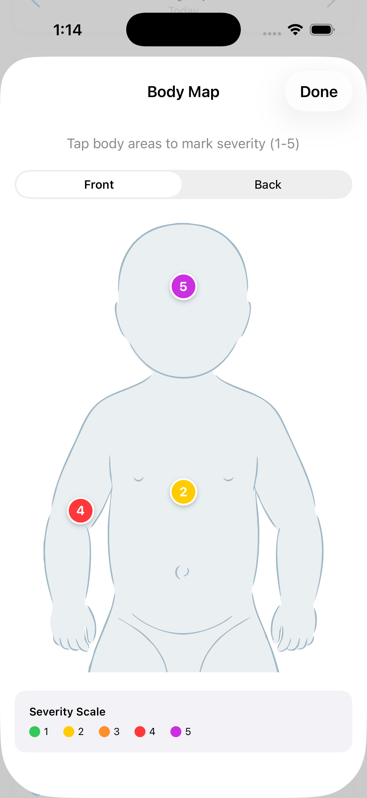 Interactive body map with severity markers on different body regions